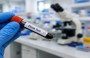 Φόβοι για Έμπολα στη Βραζιλία – Σε απομόνωση άνδρας από το Κονγκό με πυρετό