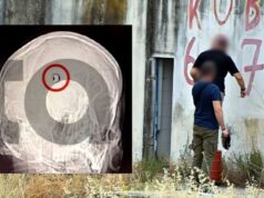 Άργος: «Ευθεία η βολή, δεν προκύπτει εξοστρακισμός» – Η μαγνητική δείχνει τη σφαίρα στο κεφάλι του 20χρονου
