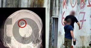 Άργος: «Ευθεία η βολή, δεν προκύπτει εξοστρακισμός» – Η μαγνητική δείχνει τη σφαίρα στο κεφάλι του 20χρονου